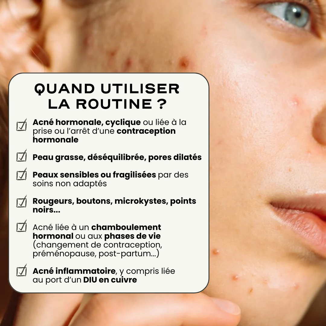 Routine Acné SOS - Image 3