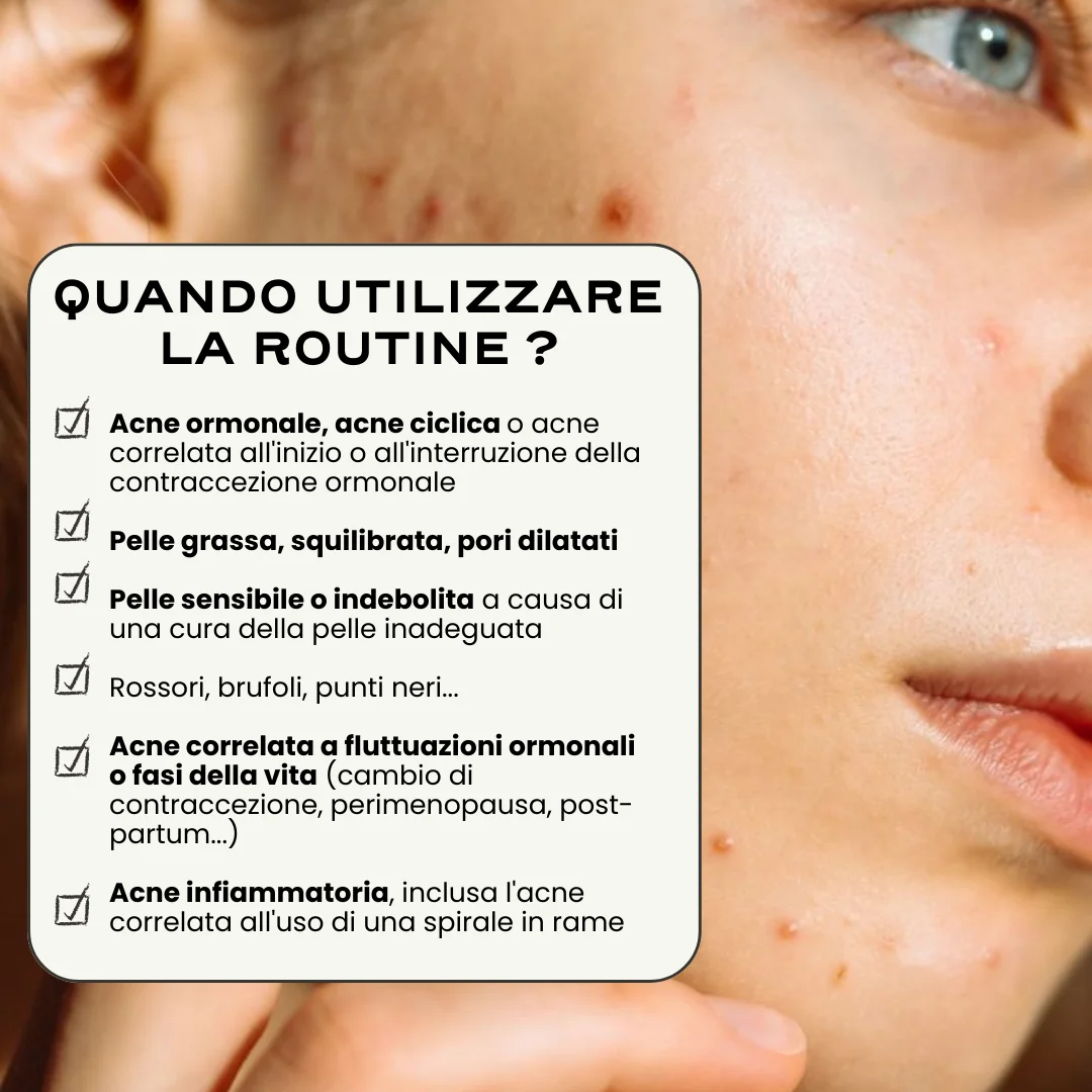 Routine Acne Universale. - Image 5