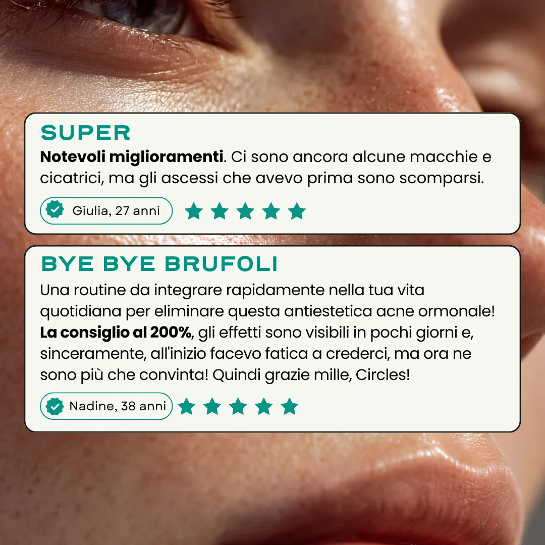 Routine Acne Universale. - Image 7