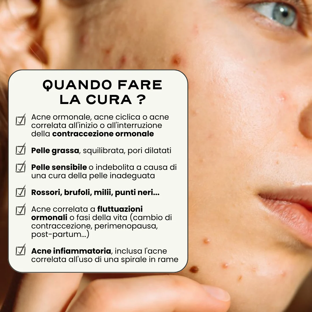 SOS Acne "In & Out". - Image 5